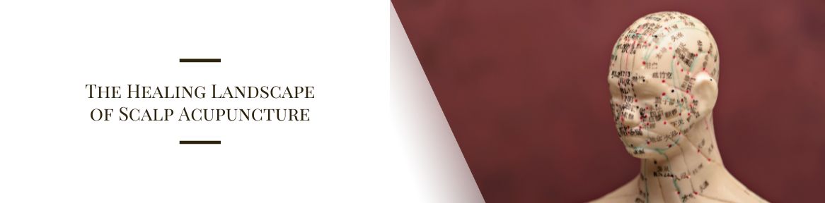 The Healing Landscape of Scalp Acupuncture 