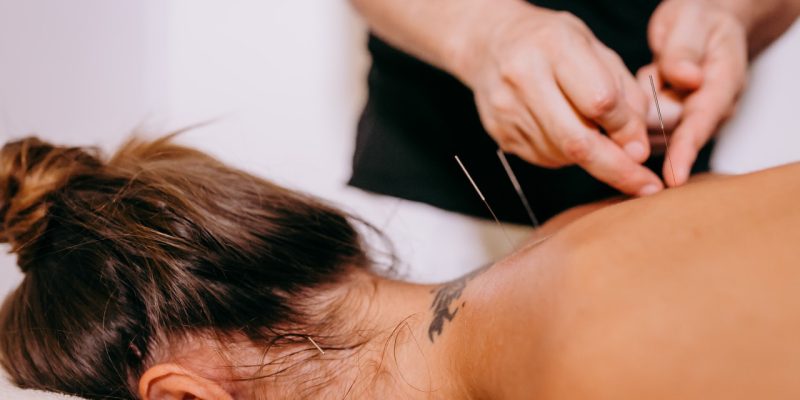acupuncture-back-neck