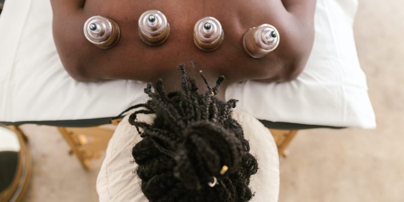 photo of cupping treatment